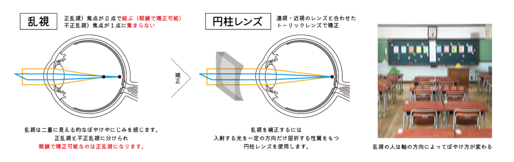 お子さんの乱視はどう見えているの? | 子供専門眼鏡店めがねのわ